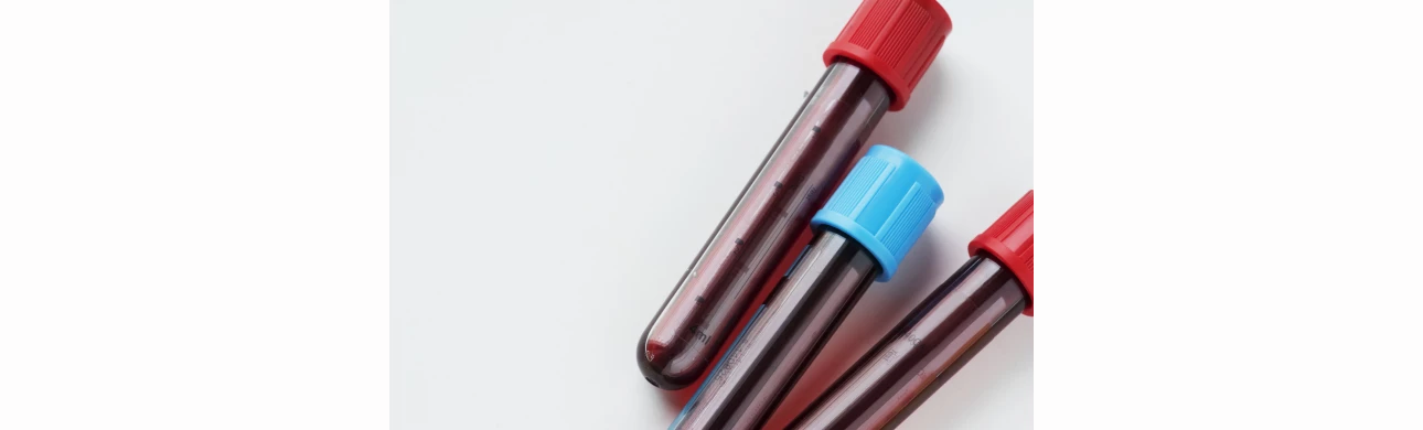 Covid-19 a transfuzní služba - aktuálního stav zásob transfuzních přípravků a dostatku dárců
